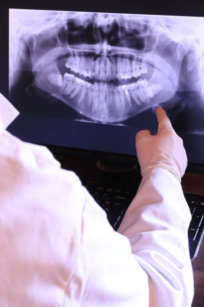 Best Emergency Root Canal Treatment in Brooklyn, IN