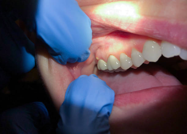 Best Emergency Dentist for Special Needs Patients in Brooklyn, IN