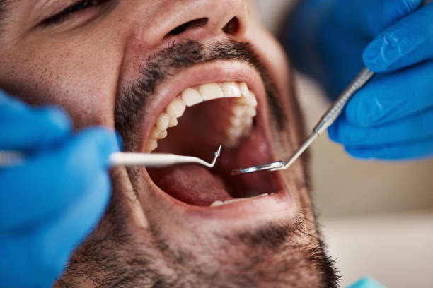 Best Emergency Dentist for Special Needs Patients in Brooklyn, IN